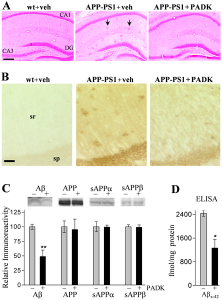 PADK Clears Intraneuronal Abeta in Aged AD-Transgenic Mice