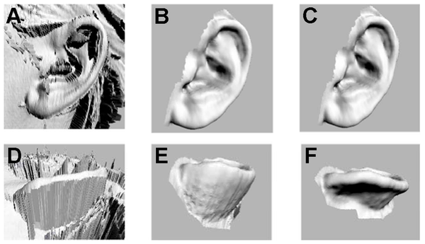 Figure 1 Digitization process for human ears.