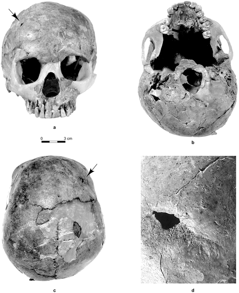Figura 1 El cráneo Qafzeh 11.